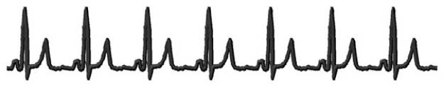 Picture of Heartbeat Machine Embroidery Design