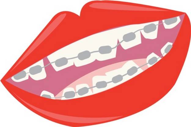 Picture of Braces Teeth SVG File